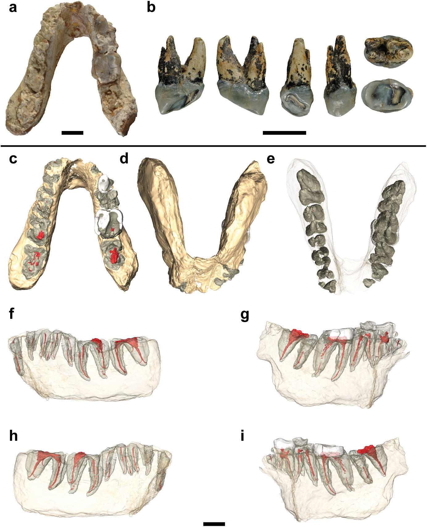 Graceopithecus teeth and mandibles